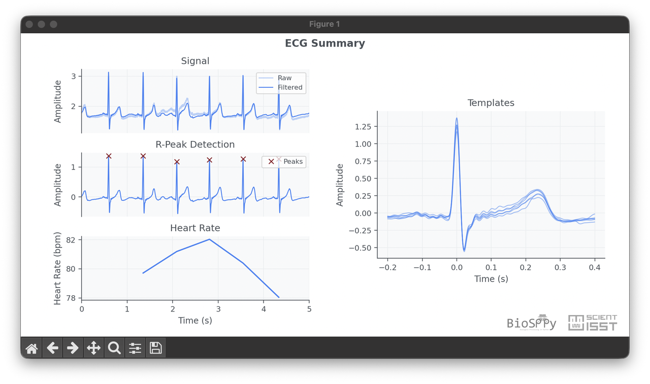 ECG summary showing signal filtering, R-peak detection, heart rate, and heartbeat templates.