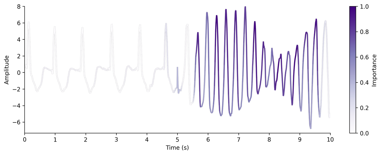 Grad-CAM example: five seconds of non-shockable ECG followed by five seconds of ventricular fibrillation/flutter. Darker purple marks regions with greater influence on the prediction.