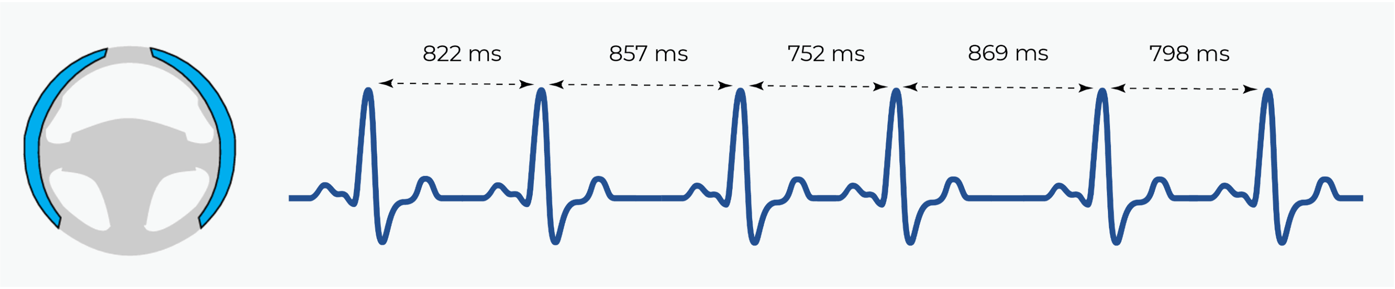 Heart rate variability (HRV) changes during drowsiness and arrhythmias, providing early warning signs before behavioral symptoms appear.